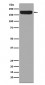 ErbB4 (17H18) Rabbit Monoclonal Antibody